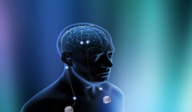 implante-cerebral-neuralink