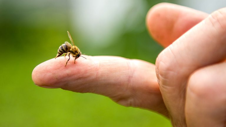 picadura-abeja-130130