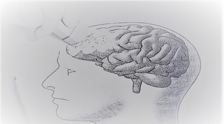 alzheimer