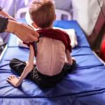 Gaza-Nino-Desnutricion-1