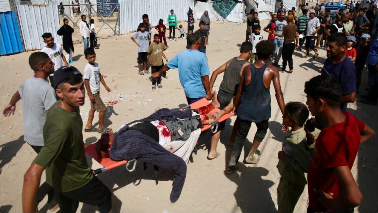 cortesia-un-palestino-herido-mientras-buscaba-ayuda-humanitaria-en-el-corredor-rafah-45596