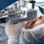 eye-surgery-recovery-tips-1