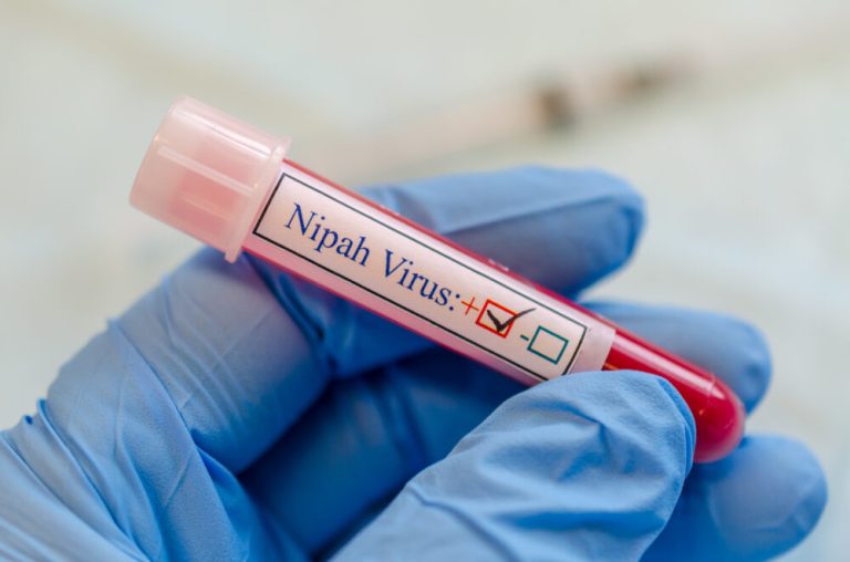 Nipah virus positive blood sample