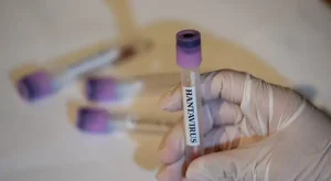 Federacion-Medica-pide-actuacion-ante-casos-de-hantavirus-en-Anzoategui